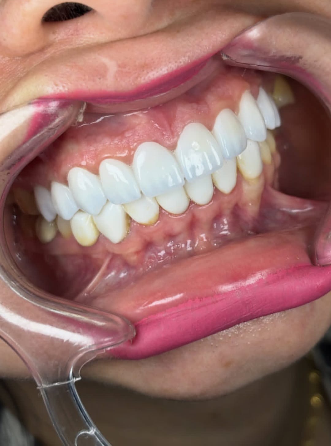 Crown Dental Clinic gallery image 2